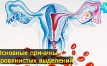 Почему у женщин идут кровянистые выделения, какие они бывают