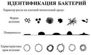 Сложности идентификации бактерий в современной микробиологии