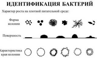 Сложности идентификации бактерий в современной микробиологии