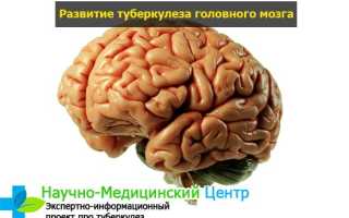 Туберкулез мозга: симптомы, разновидности, формы и способы лечения
