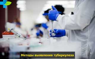 Квантифероновый тест на туберкулез