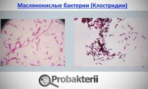 Особенности и применение маслянокислых бактерий