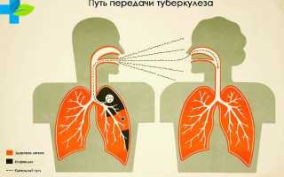 Лечится ли туберкулез? Как определить заболевание?
