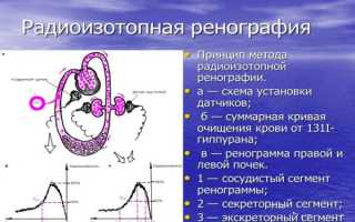 Радиоизотопное исследование: современный подход к диагностике