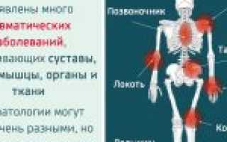 5 главных признаков, по которым можно выявить ревматизм и всё о причинах и лечении