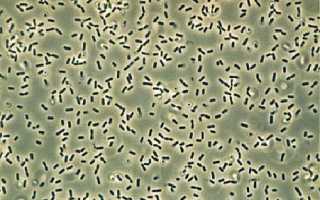Bacillus subtilis: основные свойства, характеристики, особенности