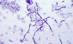 «Субтильная» сенная бацилла – палочка Bacillus subtilis