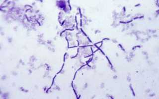 «Субтильная» сенная бацилла – палочка Bacillus subtilis