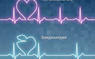 ЭКГ: описание процедуры и правильная расшифровка результатов