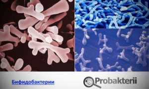 Как создать для бифидобактерий благоприятную среду и зачем это нужно