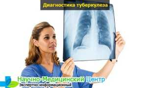 Можно ли делать манту при насморке и кашле