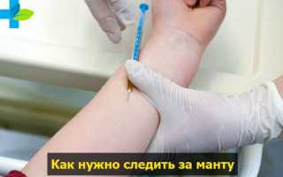 Рекомендации после манту: через сколько дней можно мыться?