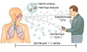 Почему люди умирают от заражения коронавирусом и для кого он больше всего опасен