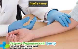 Манту: что это такое?