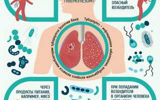 Причины туберкулеза, формы и виды заболевания