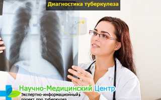 Как можно определить туберкулез на рентгене. Особенности процедуры