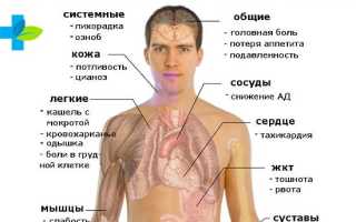 Может ли пневмония перейти в опасное заболевание туберкулез