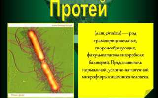 Переменчивый протей – возбудитель опасной болезни или бактерия нормальной микрофлоры?