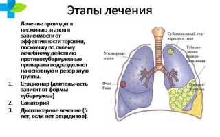 Если Вам поставили диагноз туберкулёз: можно ли его вылечить?