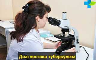 Правила туберкулинодиагностики: что будет, если намочить Манту