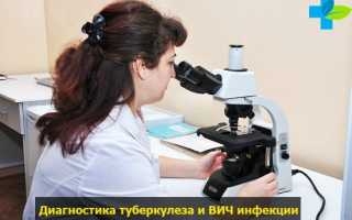 Туберкулёз и ВИЧ, как передаётся, чем лечится