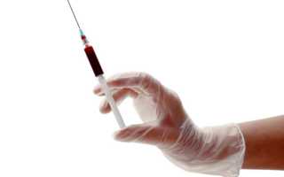 Принцип проведения аутогемотерапии: польза и вред