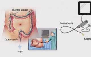 Как решиться на ФГДС или ФКС и не сойти с ума от страха