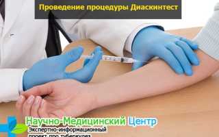 Признаки положительного диаскинтеста: дальнейшие действия