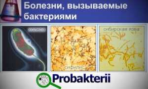 Бактерии, вызывающие развитие инфекционных заболеваний