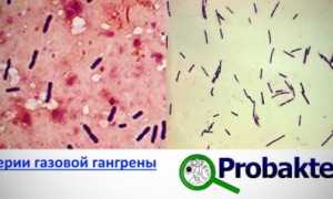 Что известно о бактериях газовой гангрены и как бороться с этой болезнью