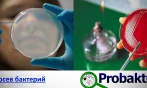 Особенности и принципы выделения чистых культур бактерий