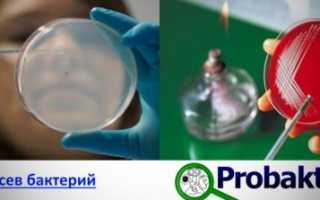 Особенности и принципы выделения чистых культур бактерий