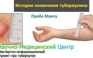 Для чего нужна прививка Манту: порядок проведения, нормы и возможные осложнения