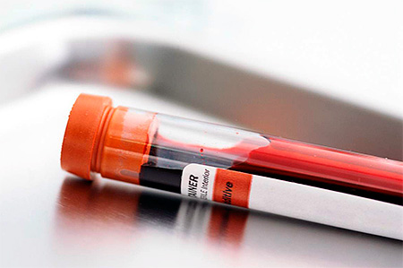 Выясняем, какие сегодня существуют виды анализов на герпетическую инфекцию... Выясняем, какие сегодня существуют виды анализов на герпетическую инфекцию...