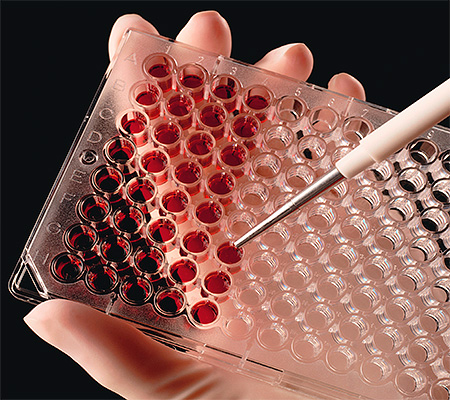 Обнаружение антител IgG к цитомегаловирусу свидетельствует о наличии у организма иммунитета к данной инфекции... Обнаружение антител IgG к цитомегаловирусу свидетельствует о наличии у организма иммунитета к данной инфекции...