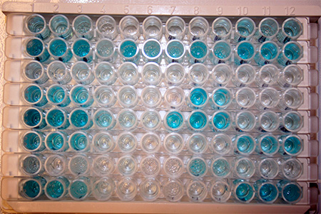 Иммуноферментный метод анализа широко используется для определения авидности иммуноглобулинов к тому или иному вирусу. Иммуноферментный метод анализа широко используется для определения авидности иммуноглобулинов к тому или иному вирусу.