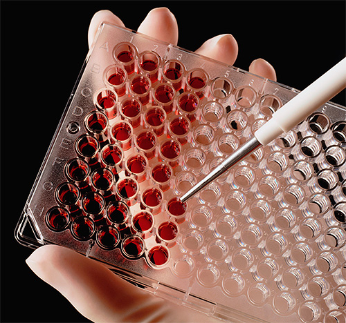 Сегодня существует множество методов анализа для диагностирования генитального герпеса. Сегодня существует множество методов анализа для диагностирования генитального герпеса