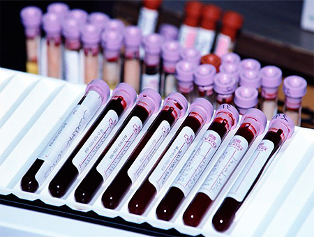 Наличие антител класса IgG к ЦМВ-инфекции еще не является поводом для паники... Наличие антител класса IgG к ЦМВ-инфекции еще не является поводом для паники...