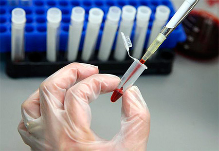 Выясняем, какое значение содержания в крови IgG к ЦМВИ является нормальным... Выясняем, какое значение содержания в крови IgG к ЦМВИ является нормальным...