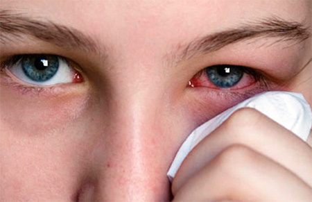 Знакомимся с офтальмогерпесом - опасным вирусным заболеванием, способным привести к потере зрения... Знакомимся с офтальмогерпесом - опасным вирусным заболеванием, способным привести к потере зрения...