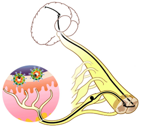 На картинке показано, как частицы вируса способны проникать из клеток спинного мозга к поверхности кожи. На картинке показано, как частицы вируса способны проникать из клеток спинного мозга к поверхности кожи.
