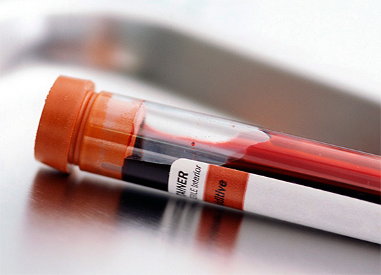 Определить тип герпесвируса, присутствующего в организме человека, можно по антителам, содержащимся в крови... Определить тип герпесвируса, присутствующего в организме человека, можно по антителам, содержащимся в крови...