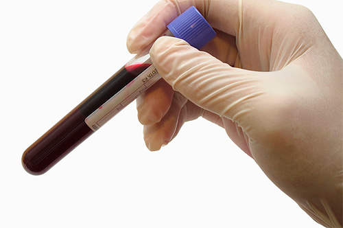 Иногда для точной диагностики причины заболевания требуются уточняющие анализы Иногда для точной диагностики причины заболевания требуются уточняющие анализы