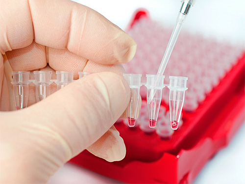 Существуют довольно точные лабораторные методы диагностирования герпангины, однако в большинстве случаев хватает простого осмотра у опытного врача. Существуют довольно точные лабораторные методы диагностирования герпангины, однако в большинстве случаев хватает простого осмотра у опытного врача.