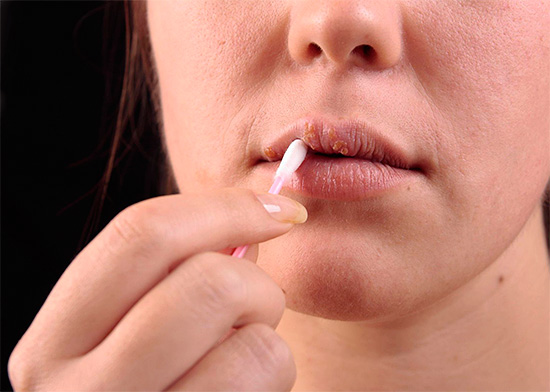 Адекватное лечение в случае заболевания позволит снизить интенсивность неприятных симптомов болезни. Адекватное лечение в случае заболевания позволит снизить интенсивность неприятных симптомов болезни.