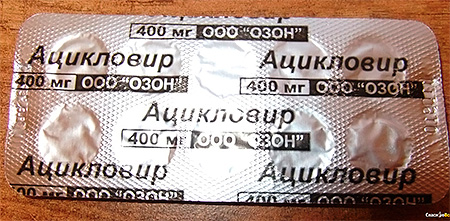 Препараты на основе ацикловира сегодня широко применяются для лечения различных заболеваний, вызываемых вирусами герпеса Препараты на основе ацикловира сегодня широко применяются для лечения различных заболеваний, вызываемых вирусами герпеса