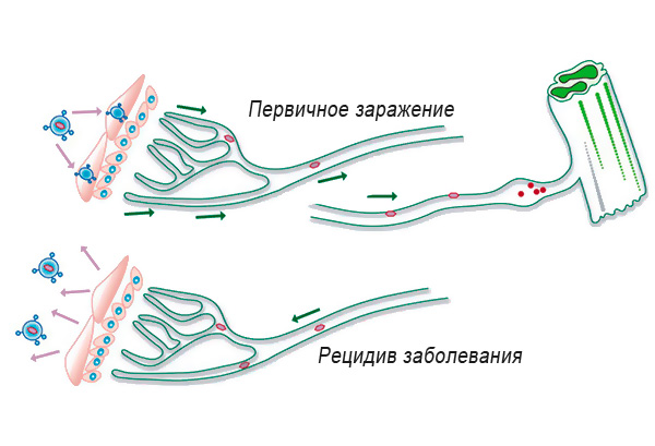 На картинке схематично показан механизм заражения организма вирусом и возникновение последующего рецидива болезни. На картинке схематично показан механизм заражения организма вирусом и возникновение последующего рецидива болезни.