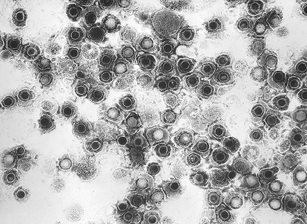Частицы вируса Herpes simplex под электронным микроскопом Частицы вируса Herpes simplex под электронным микроскопом