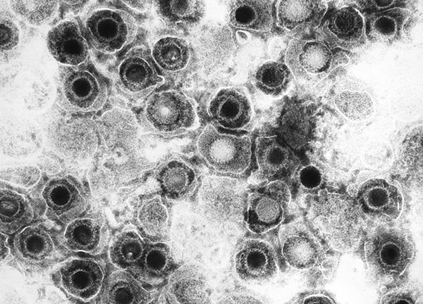 Частицы вируса HSV-1 под микроскопом Частицы вируса HSV-1 под микроскопом