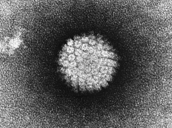 Вирион Herpes simplex при сильном увеличении Вирион Herpes simplex при сильном увеличении